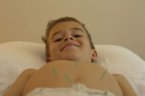 child acupuncture