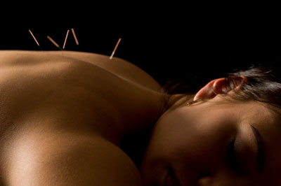 Acupuncture Back Pain