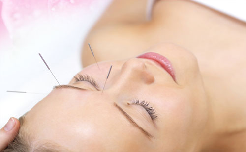 cosmetic acupuncture