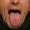 tongue-diagnosis[1]